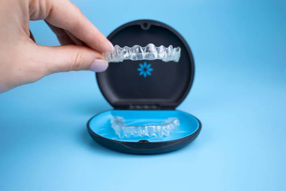 invisalign aligners at OBDS