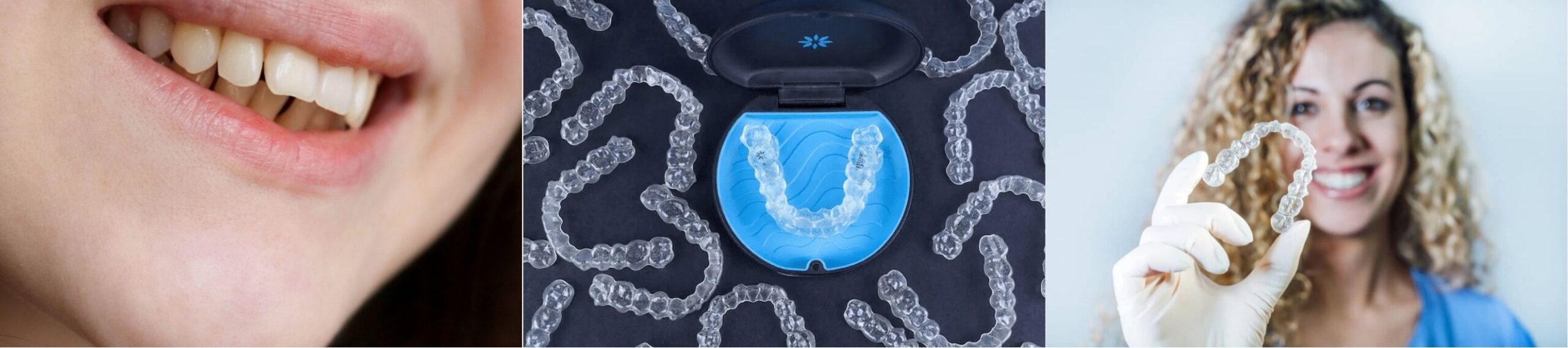 what defines invisalign price in winchester: complexity, duration and expertise