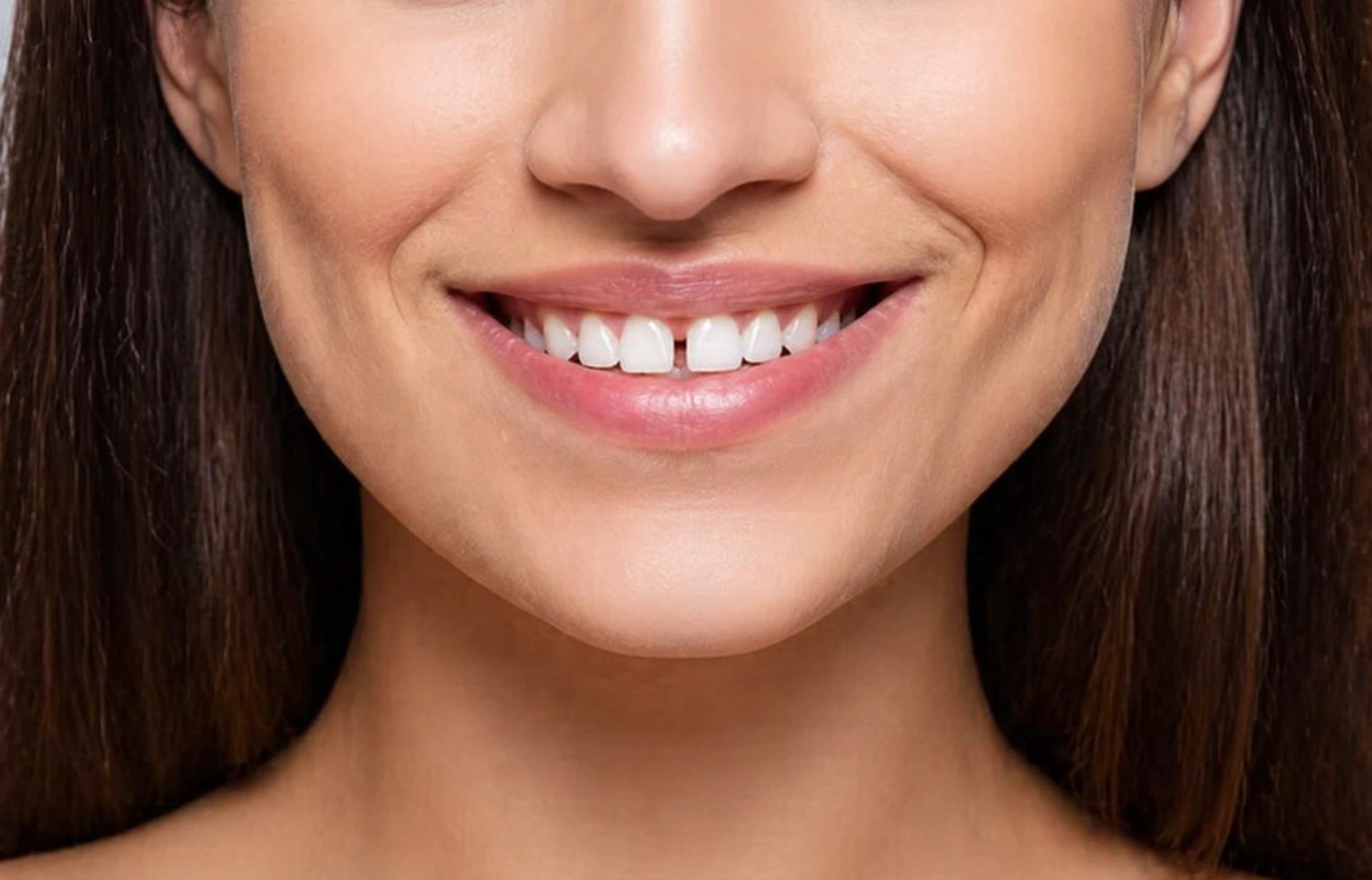 gap between teeth