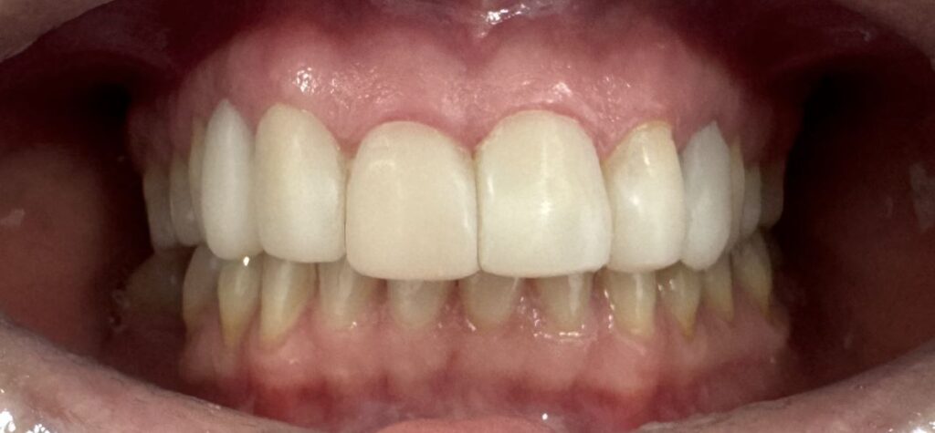 After treatment: Oliver’s Battery Dental Surgery, Winchester