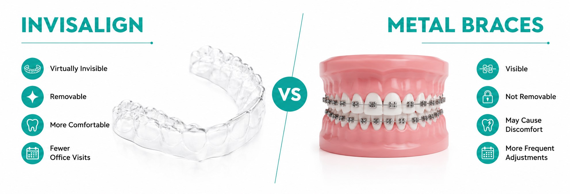 invisalign vd braces invisalign vd braces in winchester, uk