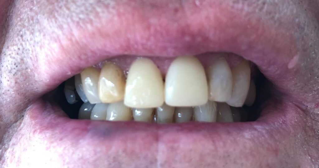 After treatment: Oliver’s Battery Dental Surgery, Winchester