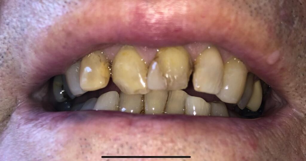 Before treatment: Oliver’s Battery Dental Surgery, Winchester